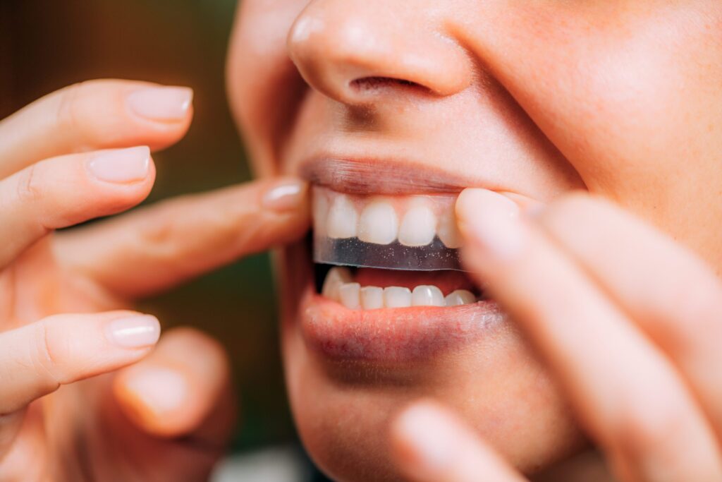 crest whitening strips