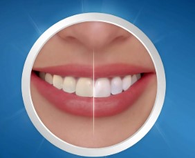 crest 3d white strips